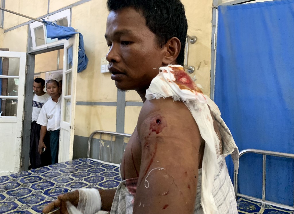 An injured man from Kyauk Tan village in Rathedaung township sits on a bed in a hospital in Rakhine state's capital Sittwe in western Myanmar on May 2, 2019, after the army opened fire on a group of ethnic Rakhine detainees at a school in the village (STR / AFP).