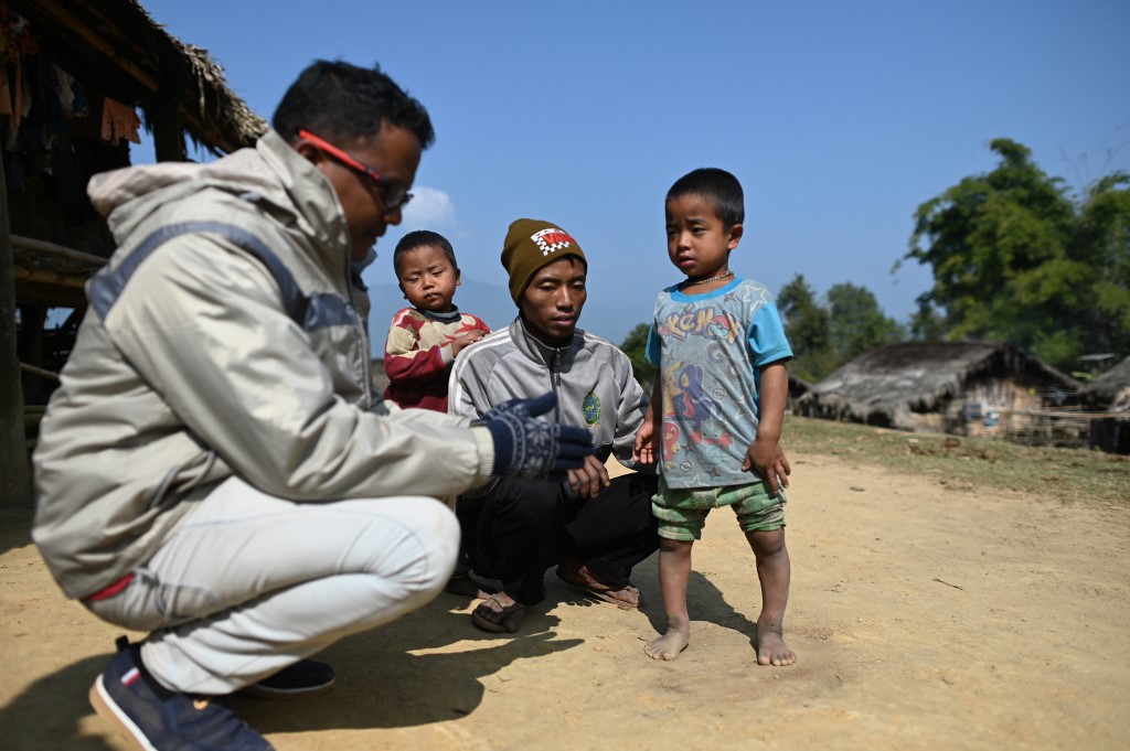 This photo taken on February 4, 2020 shows Medical Action Myanmar (MAM) doctor Zaw Min Lay (L) talking to a father, whose son has rickets (R), in Tow Law village in Lahe township, (Ye Aung Thu / AFP)