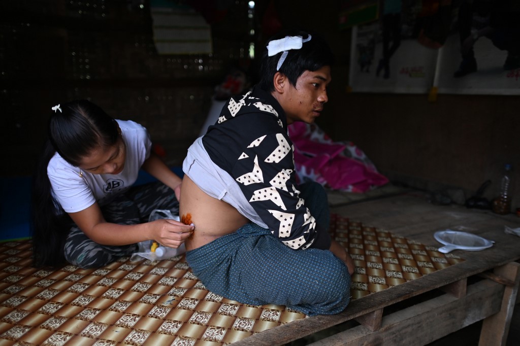 This photo taken on July 4, 2020 shows Pan Ei Phyu (L) treating her husband Sai Ko (R), who survived a deadly landslide in an area of open-cast jade mines, near Hpakant in Kachin state. (Ye Aung Thu / AFP)