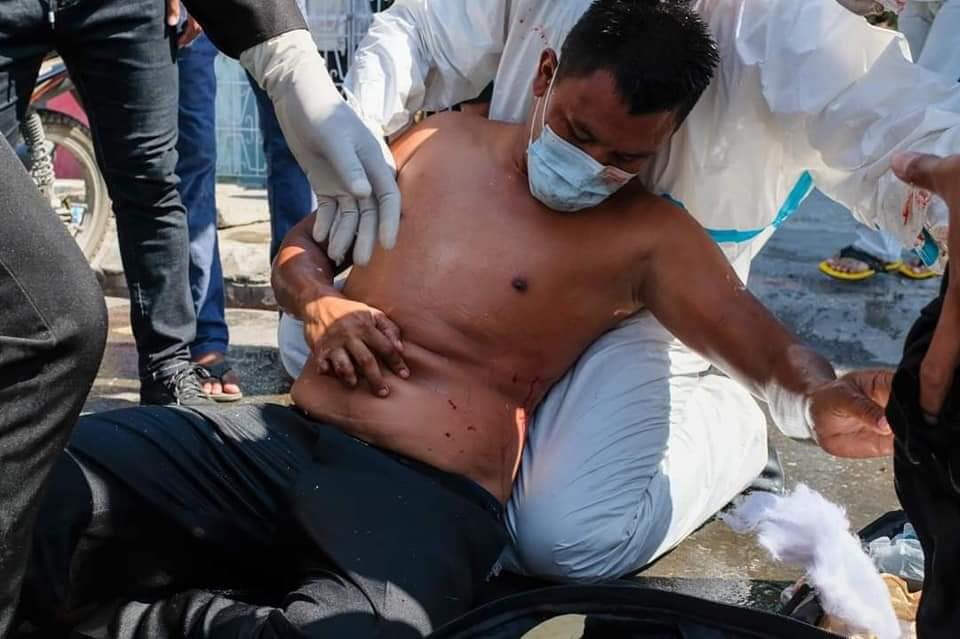  A medical team gives first aid to a man injured after police used a water cannon on protesters holding a demonstration against the military coup in Mandalay on February 9, 2021. (STR / AFP)