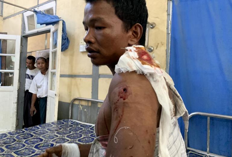 An injured man from Kyauk Tan village in Rathedaung township sits on a bed in a hospital in Rakhine state's capital Sittwe in western Myanmar on May 2, 2019, after the army opened fire on a group of ethnic Rakhine detainees at a school in the village (STR / AFP).