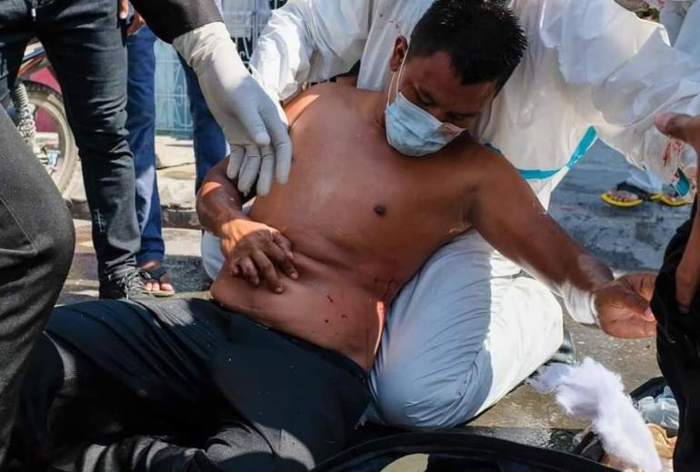  A medical team gives first aid to a man injured after police used a water cannon on protesters holding a demonstration against the military coup in Mandalay on February 9, 2021. (STR / AFP)